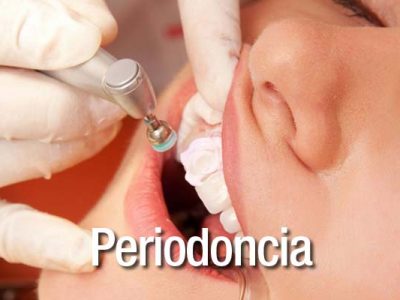 periodoncia